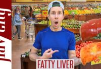 Top 10 Foods For Reversing FATTY LIVER DISEASE…And What To Avoid!