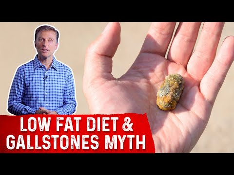 The Low Fat Diet to Prevent Gallstones "Myth" – Dr.Berg