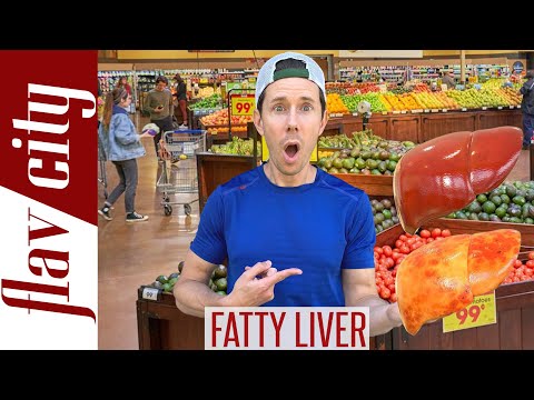 Top 10 Foods For Reversing FATTY LIVER DISEASE...And What To Avoid!